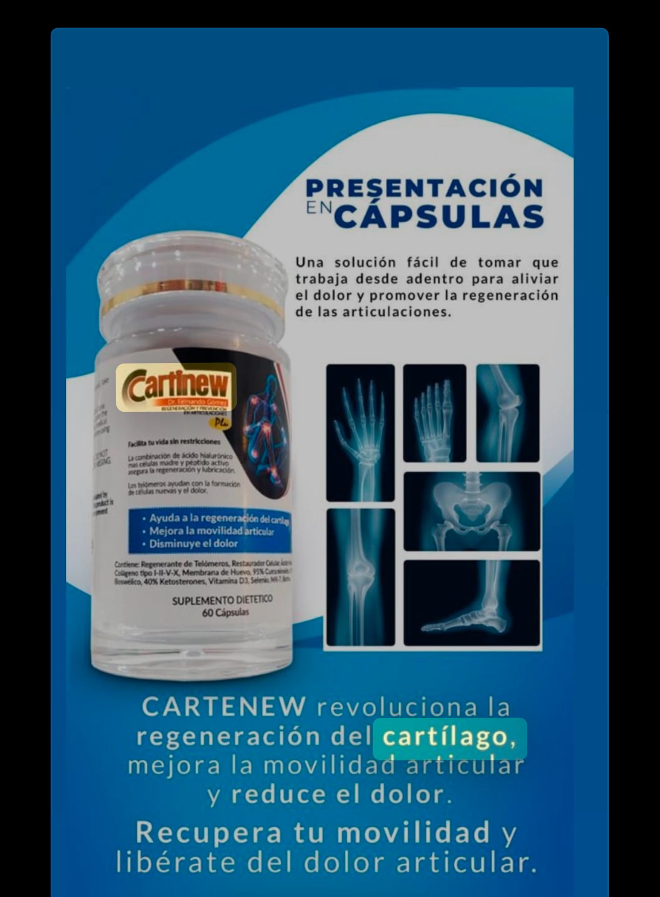 Capsulas Cartinew